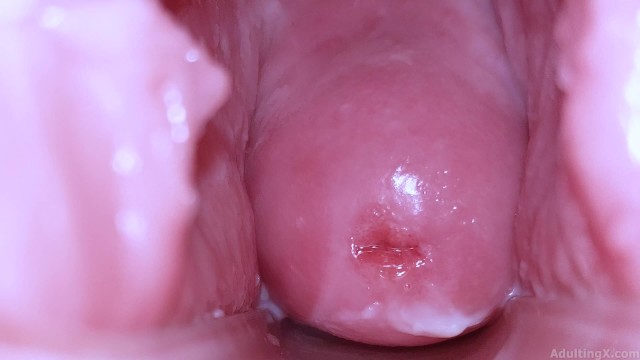 Cervical Display And Playback